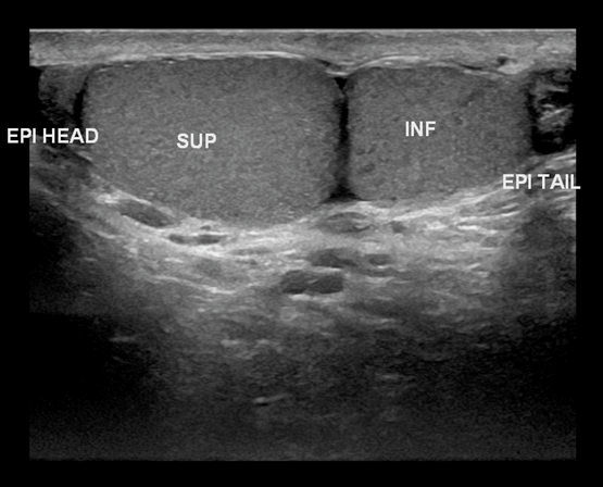 ultrasound Imagery