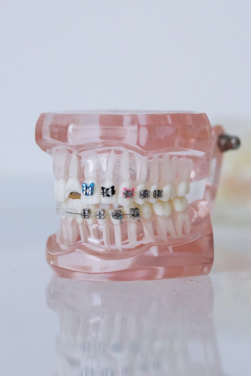 close up shot of dentures with braces